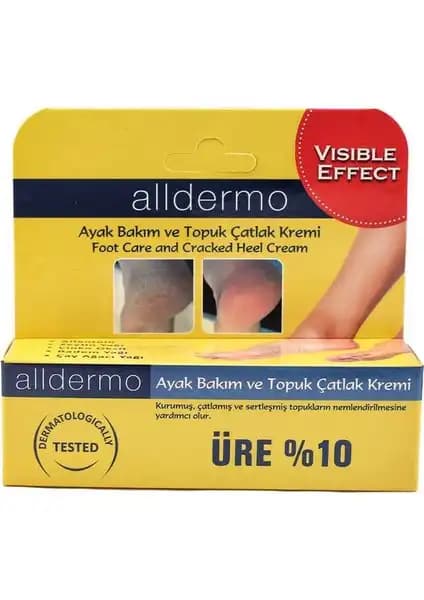 Alldermo Ayak Topuk Bakım Kremi ile Sağlıklı ve Yumuşak Ayaklar İçin En İyi Çözüm