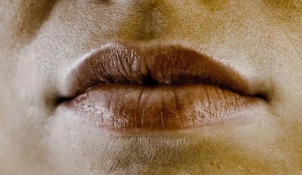 Ağız Kenarlarında Kararma ve Kozmetik Çözümler: Güzel ve Sağlıklı Bir Gülüş İçin Rehber