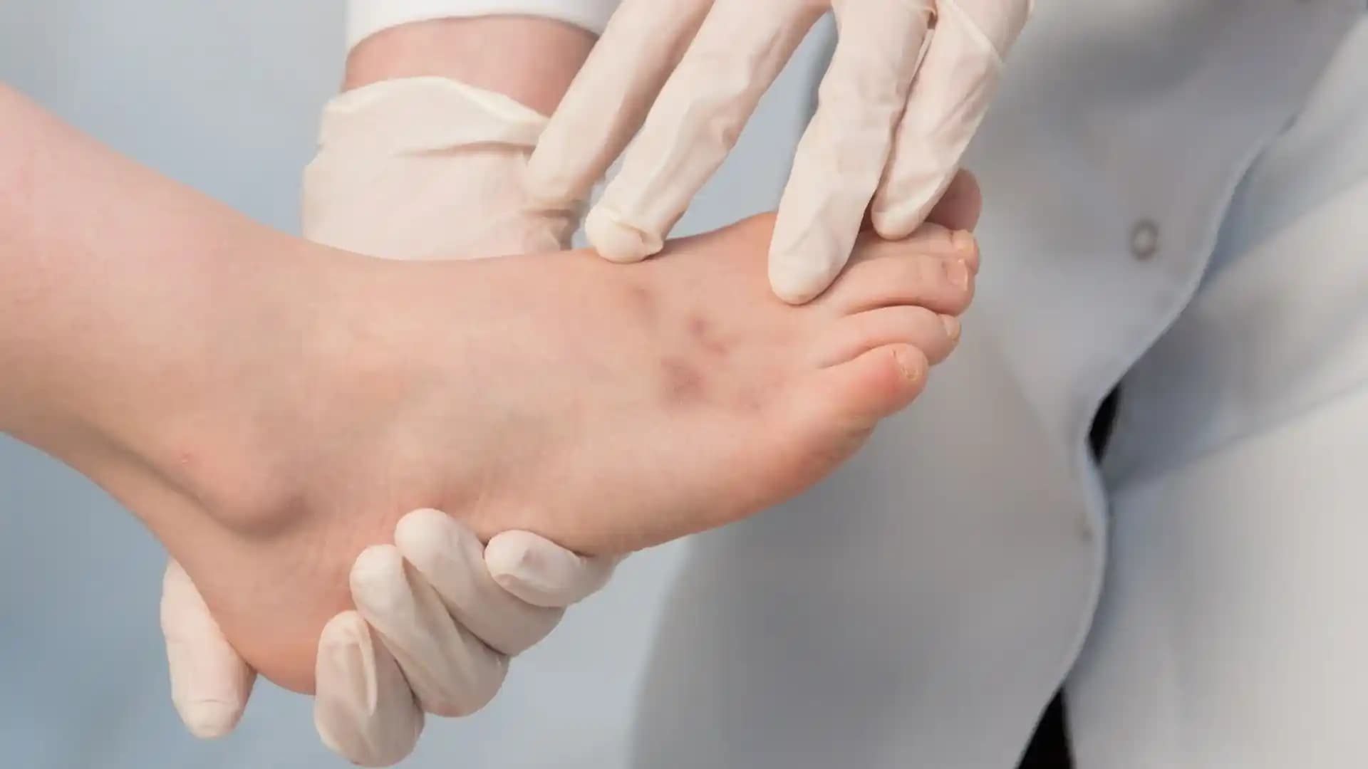 Ayak Altı Turunculuğu Nedenleri ve Sağlıklı Ayaklar İçin Alınacak Önlemler