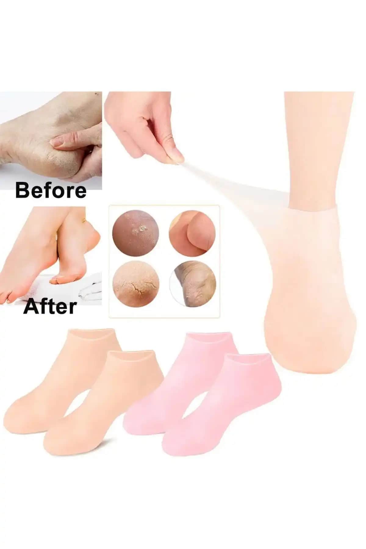 Ayak Bakımında Yeni Trend Nemlendirici Çoraplar: Sağlıklı ve Yumuşak Ayaklar İçin Rehber