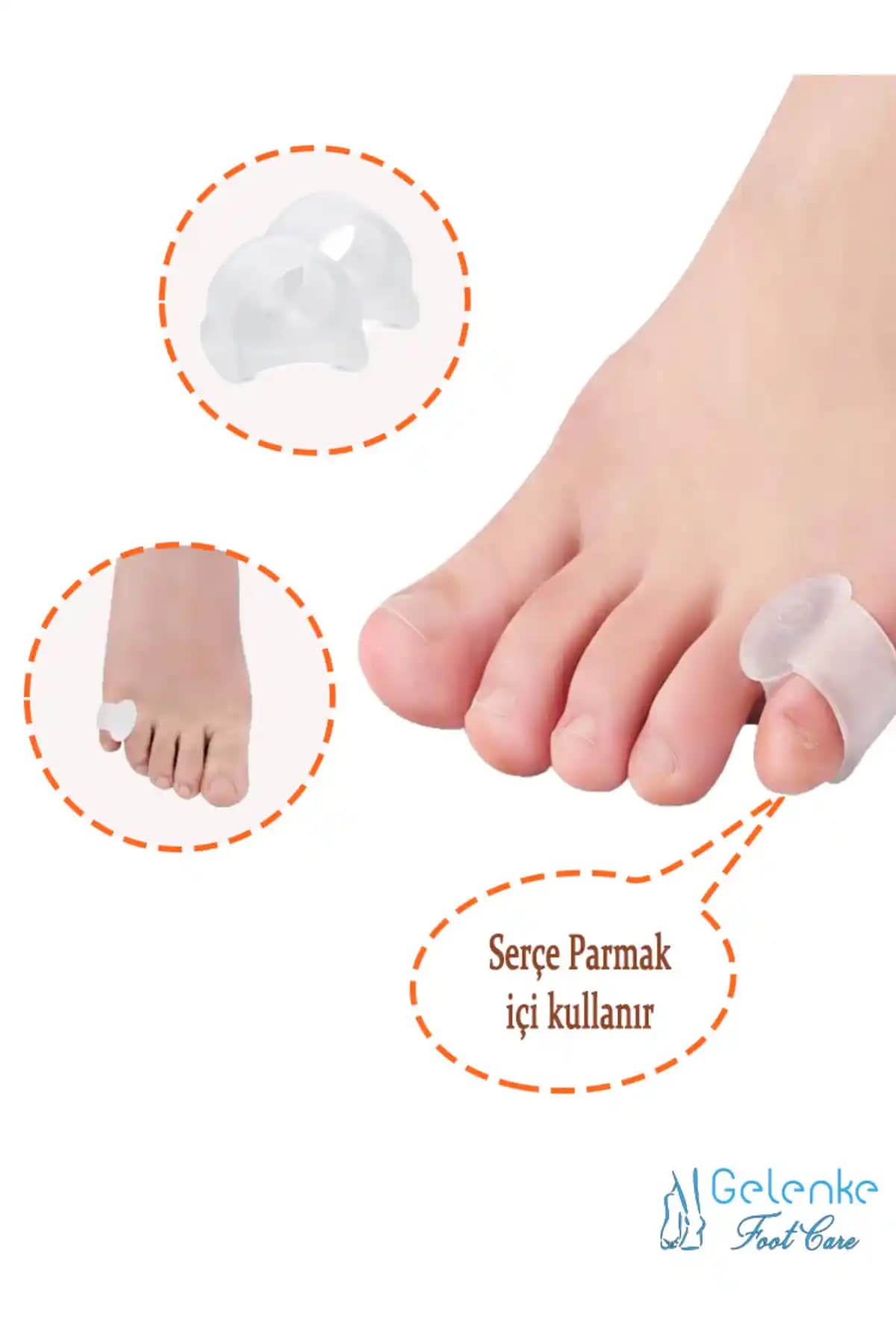 Ayak Parmak Arası Nasırları ve Etkili Tedavi Yöntemleri Hakkında Kapsamlı Bilgiler