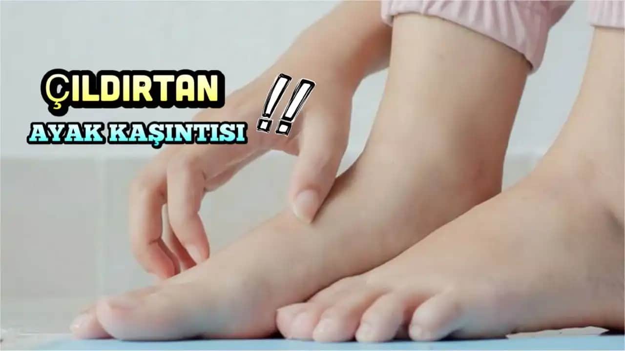 Ayak Pişiklerine Karşı Doğal ve Klinik Yöntemler ile Etkili Çözüm Rehberi