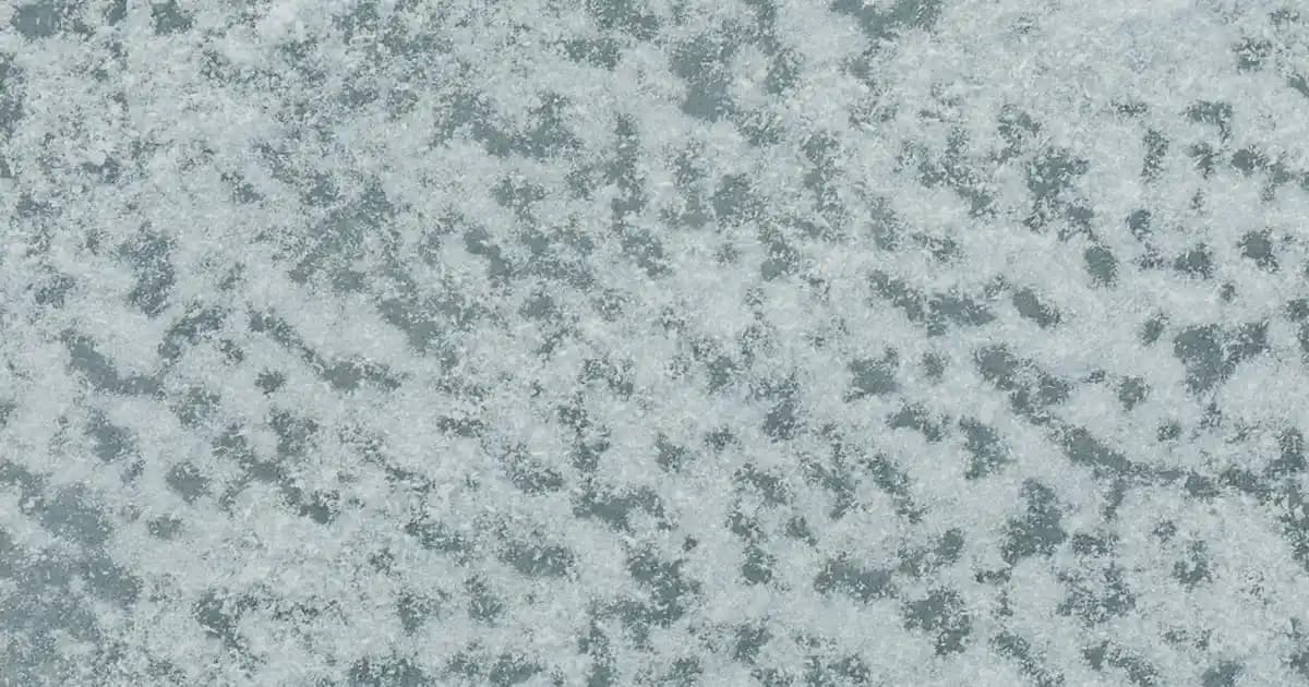 Ayak Tabanı Nasırları: Nedenleri, Belirtileri ve Etkili Tedavi Yöntemleri