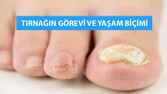 Ayak Tırnağı Kırılması Nedenleri Belirtileri ve Etkili Çözüm Yöntemleri