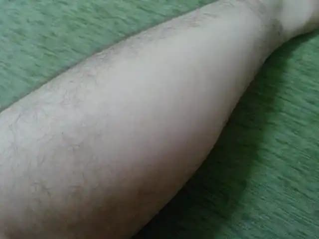 Bacak Kıllarının Dökülme Nedenleri ve Alınabilecek Önlemler Rehberi