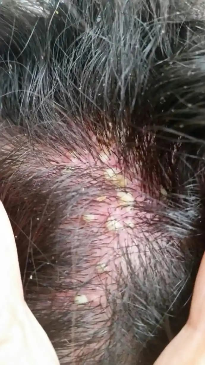 Bebeklerde Kafa Yaralarının Nedenleri, Belirtileri ve Etkili Tedavi Yöntemleri