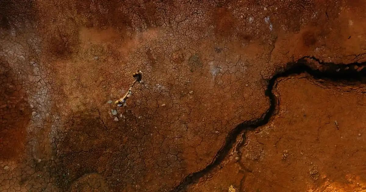 Bebeklerde Sivilce ve Kızarıklıkların Nedenleri, Tedavi Yöntemleri ve Önleyici İpuçları