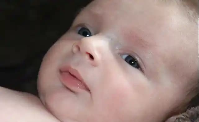 Bebeklerde Vücutta Beyaz Lekeler: Nedenleri, Türleri ve Bakım Yolları Hakkında Bilgilendirici Rehber