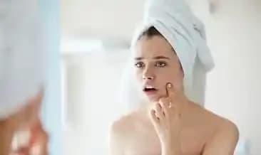 Bebeklerde Yüzde Beyaz Noktalar: Nedenleri, Belirtileri ve Doğru Bakım Yöntemleri