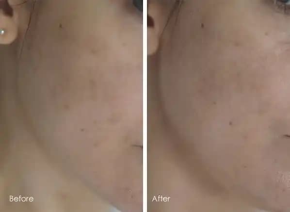 Bioderma PigmentBio Sensitive Areas Ürünleri ve Kullanım Sonrası Etkileri