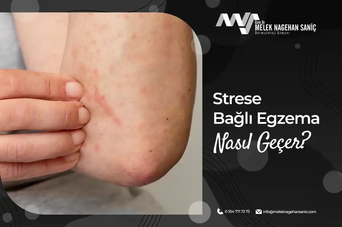 Boyunda Egzama ve Stresin Cilt Sağlığı Üzerindeki Etkileri Hakkında Bilgilendirici Rehber