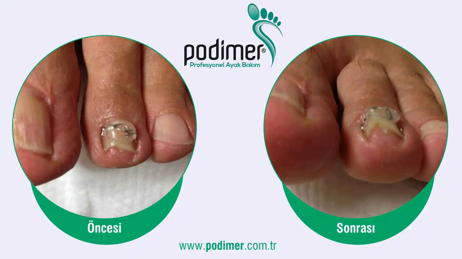 Bursa Tırnak Uygulamaları ve Trendleri: Modern Kozmetik ve Bakım Teknikleri