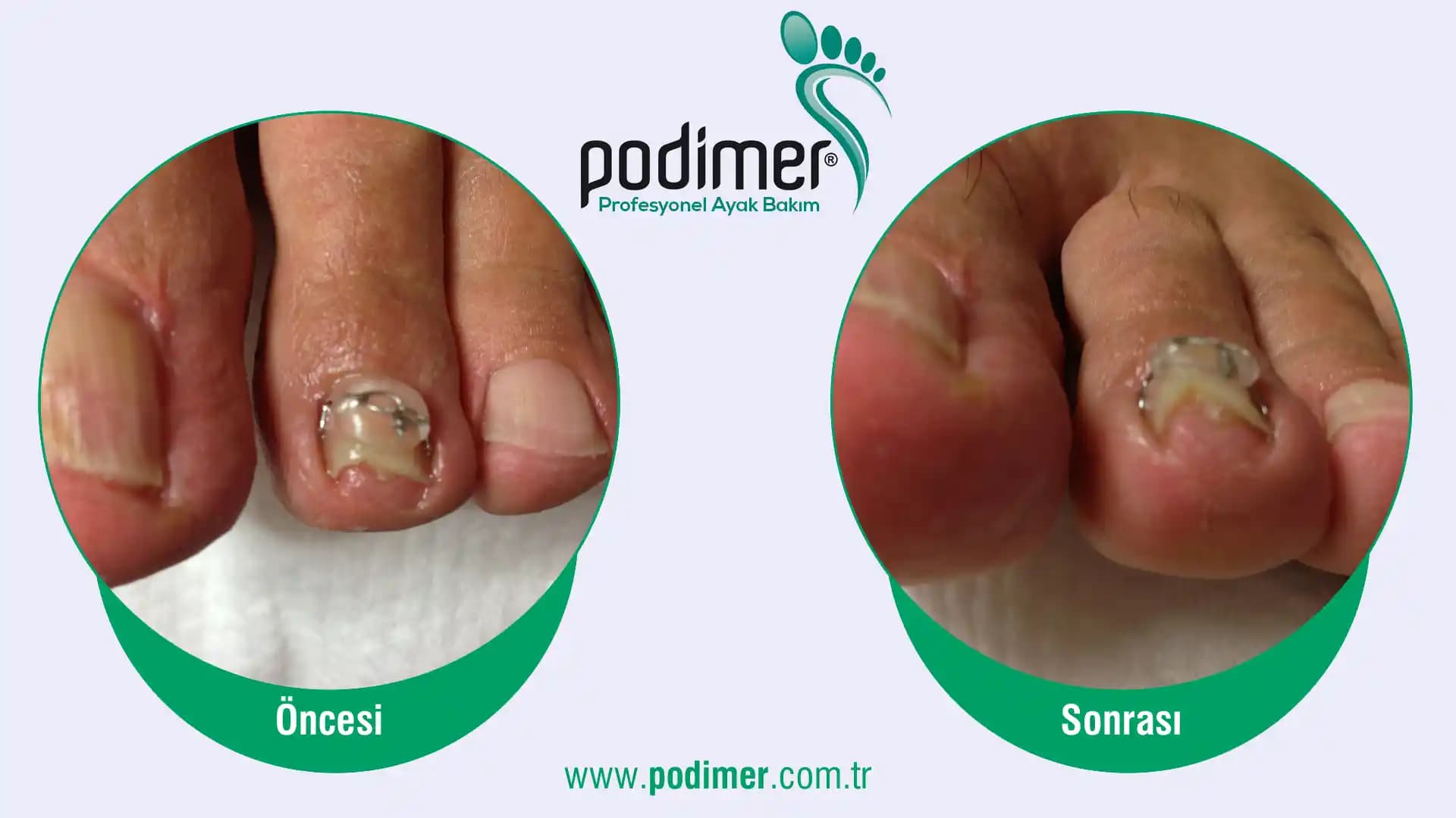 Bursa Tırnak Uygulamaları ve Trendleri: Modern Kozmetik ve Bakım Teknikleri