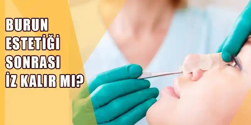 Burun Estetiği Sonrası Dikiş İzi İçin En Etkili Kremler ve Bakım İpuçları