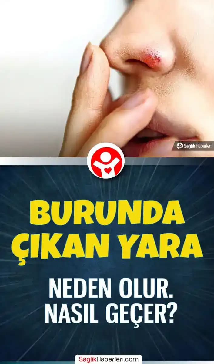 Burun Yara İzleri Nasıl Geçer Uzman Tavsiyeleri ve Etkili Çözüm Yöntemleri