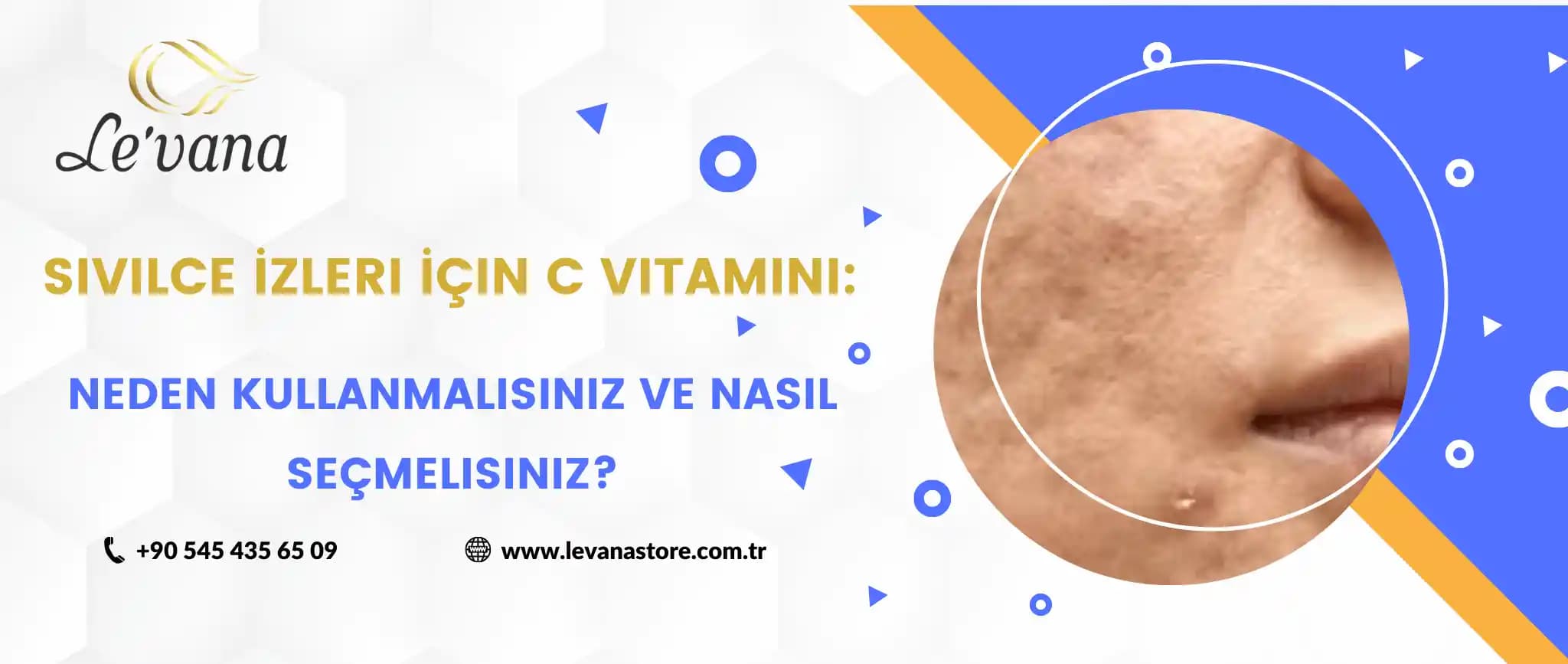C vitamini ve sivilceler arasındaki ilişki: Gerçekler ve mitler üzerine detaylı analiz