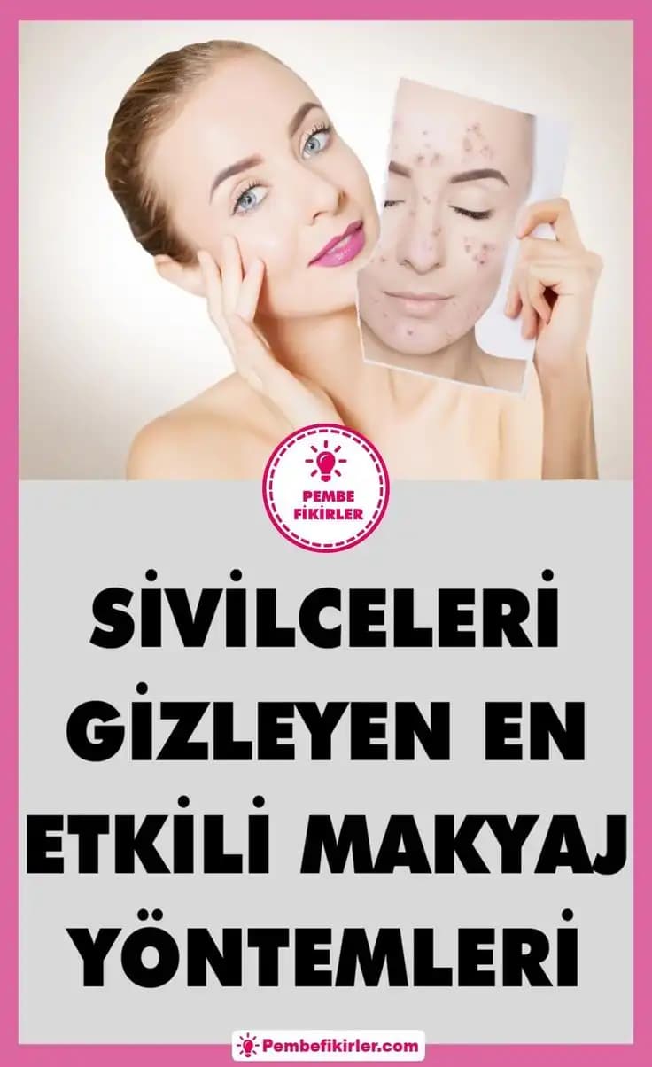 Cilt Altı Sivilceleri Nedir, Nedenleri ve Etkili Tedavi Yöntemleri