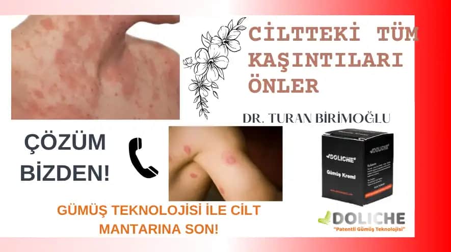 Cilt Mantarı ve Doğal Tedavi Yöntemleri: Sağlıklı Cilt İçin Etkili Çözümler ve İpuçları
