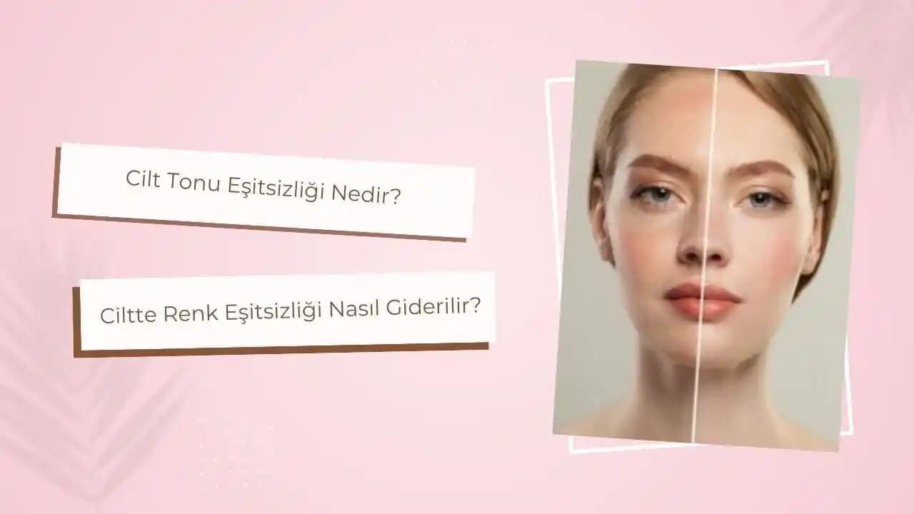 Cilt Tonu Eşitsizliği Nedenleri ve Çözüm Yöntemleri Hakkında Kapsamlı Bilgi