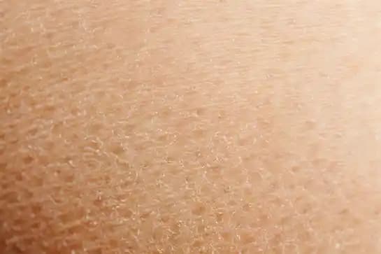 Ciltte Beyaz Pullanma Nedenleri ve Etkili Tedavi Yöntemleri