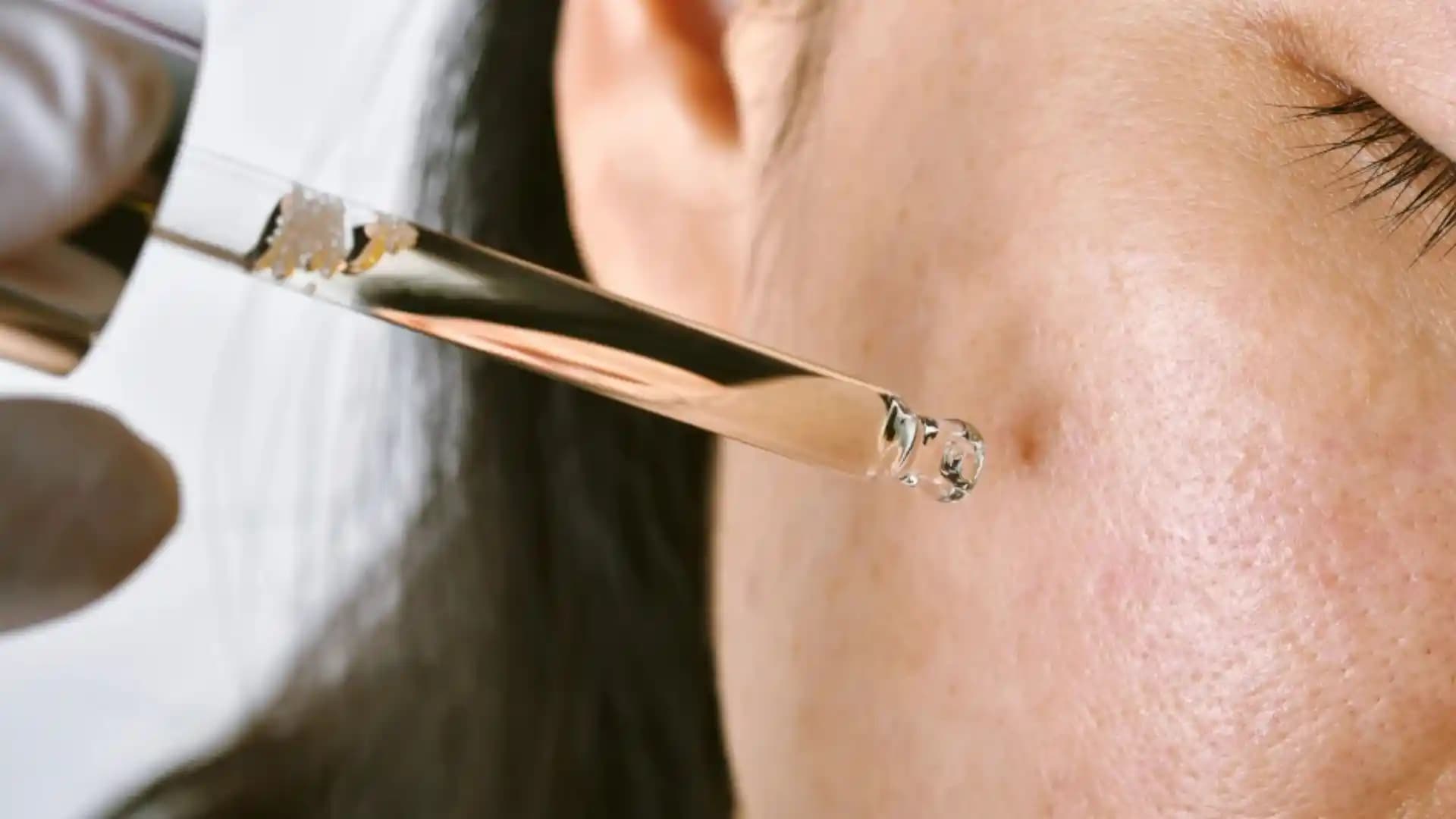 Ciltte Koyu Lekeler ve Etkili Tedavi Yöntemleri Hakkında Bilgilendirici Rehber