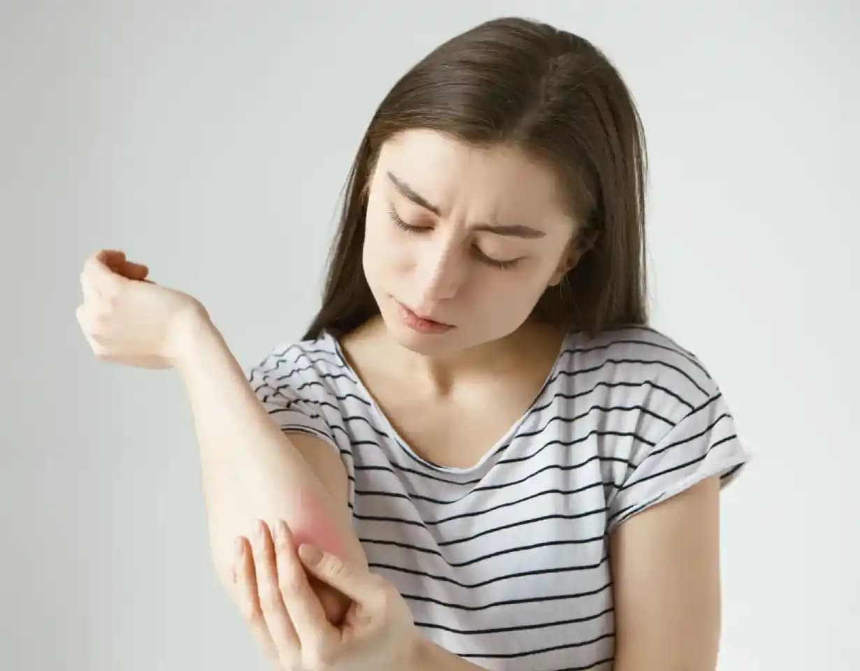 Ciltte Yanık Gibi Kızarıklıkların Nedenleri Belirtileri ve Etkili Çözüm Yolları