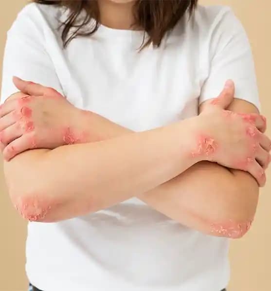 Çocuklarda Vücut Kaşıntısının Nedenleri ve Korunma Yolları