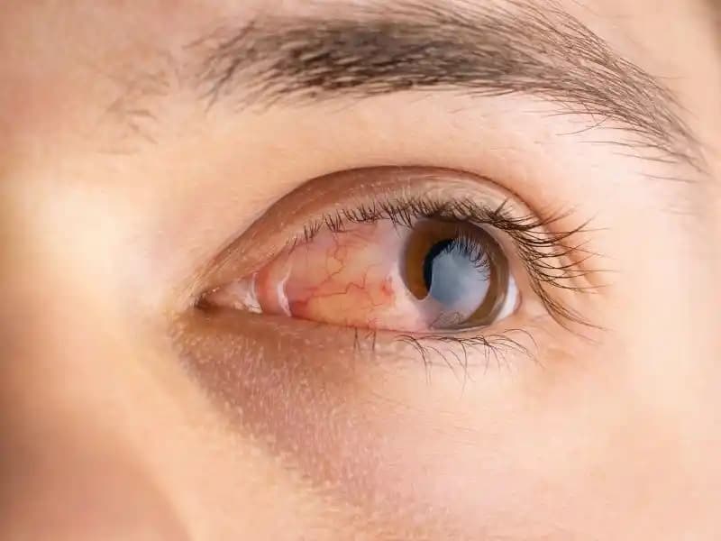 Deri Acımasının Nedenleri ve Kozmetik Bakımda Uygun Önlemler