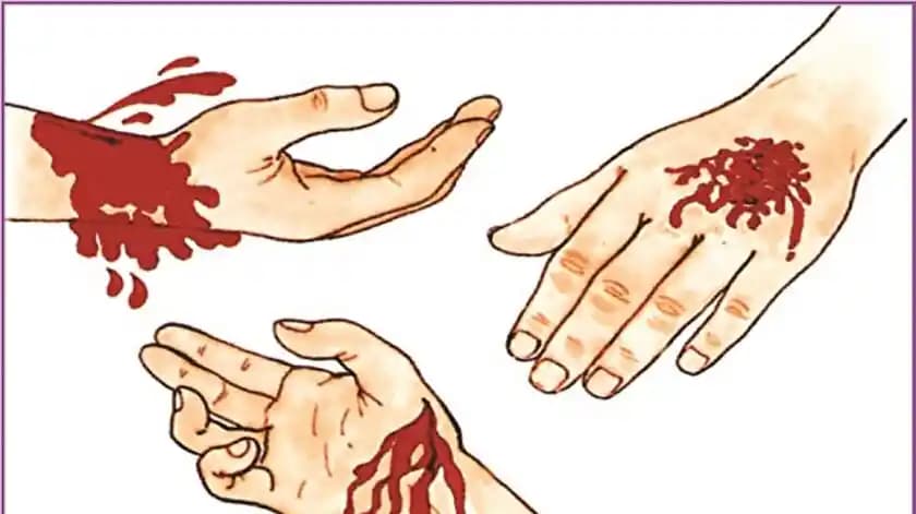 Deri Kavlaması ve Kozmetik Ürünleri Kullanımında Dikkat Edilmesi Gerekenler