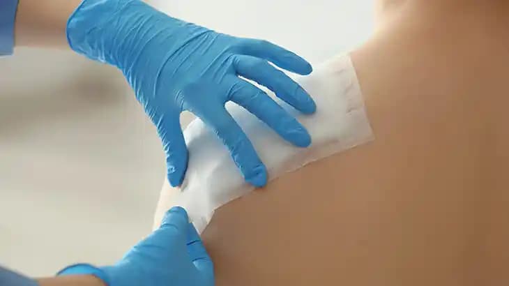 Dikişlerin Neden Kaşındığını Anlamak ve İyileşmeyi Hızlandırmak İçin Bilmeniz Gerekenler