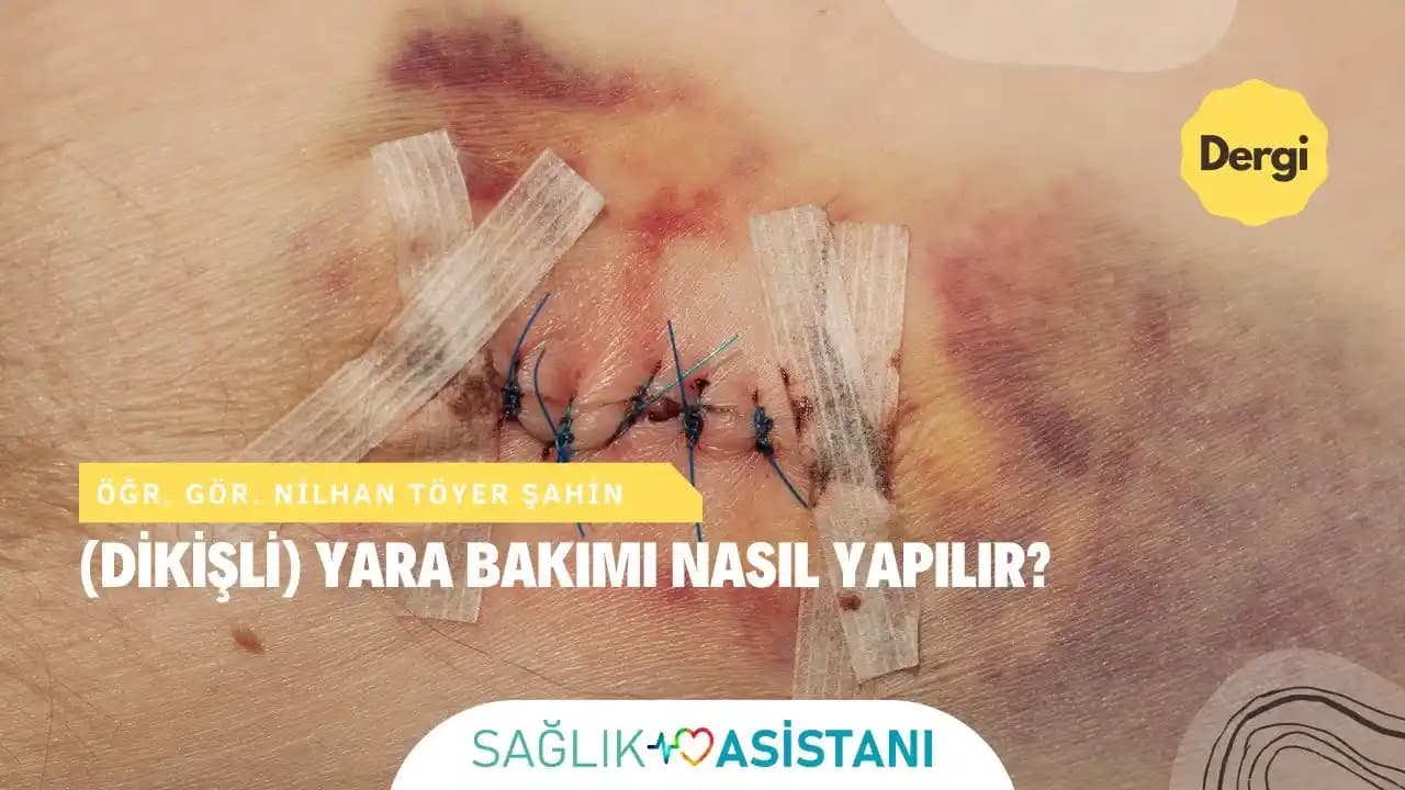 Dikişli Yaraların Estetik ve Sağlık Perspektifleriyle Bakımı ve Tedavi Yöntemleri