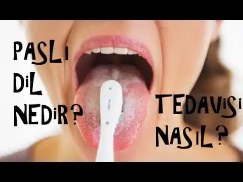 Dil Pası İlacı ve Doğal Yöntemlerle Dil Sağlığını Koruma Rehberi