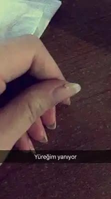 Dipten Kırılan Tırnakların Nedenleri, Etkileri ve Etkili Çözüm Yolları