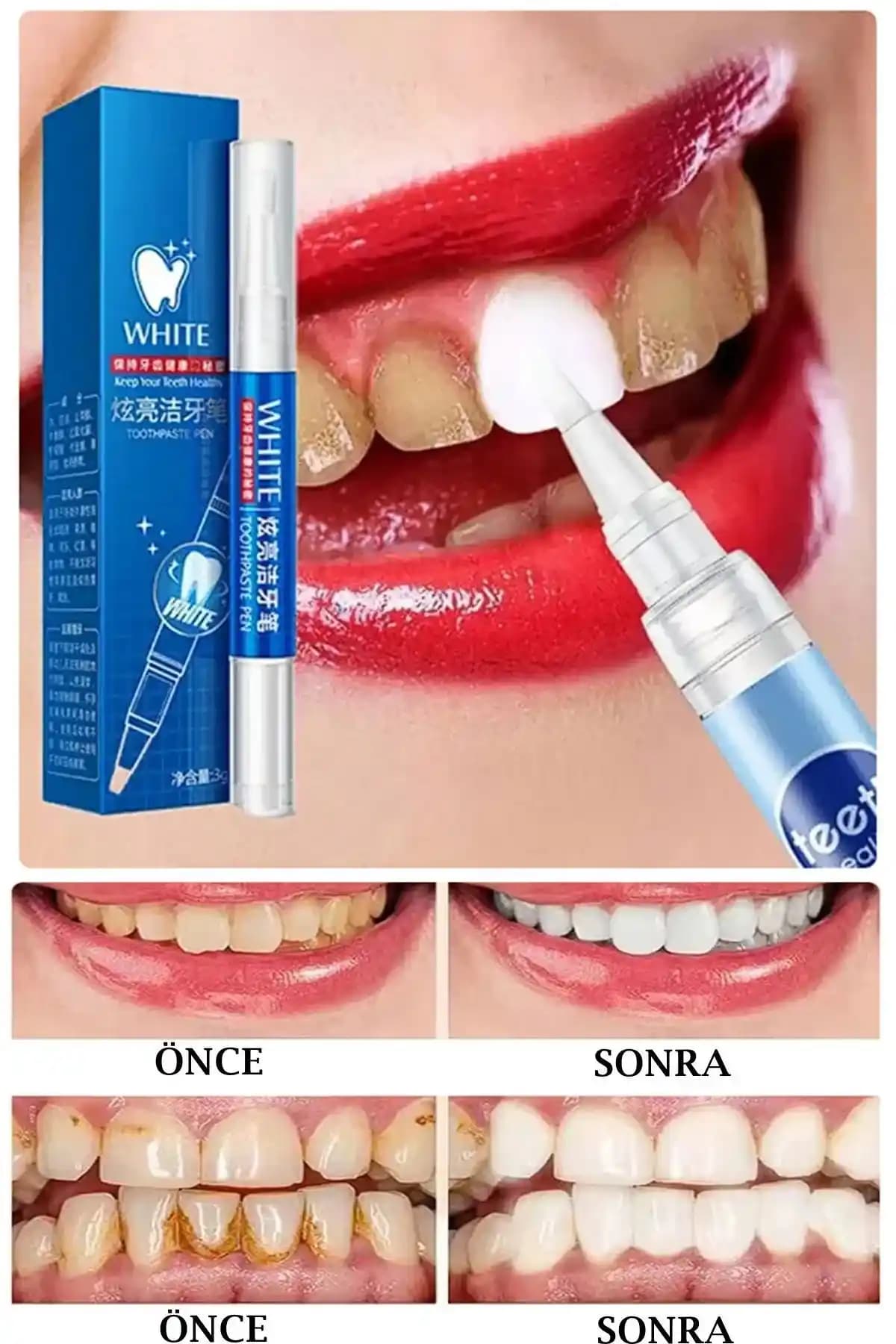 Diş Beyazlatma Jeli: Güvenilir ve Etkili Çözüm ile Parlak Gülüşler