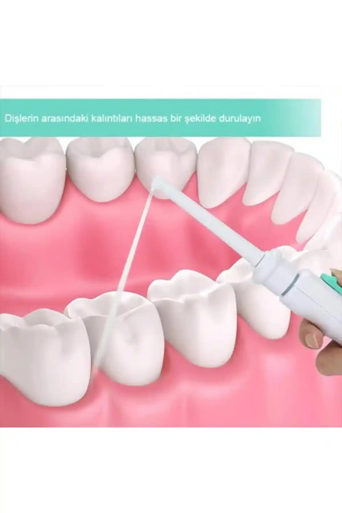 Diş Temizleme Aparatları: Çeşitleri, Kullanım Alanları ve Seçim Kriterleri