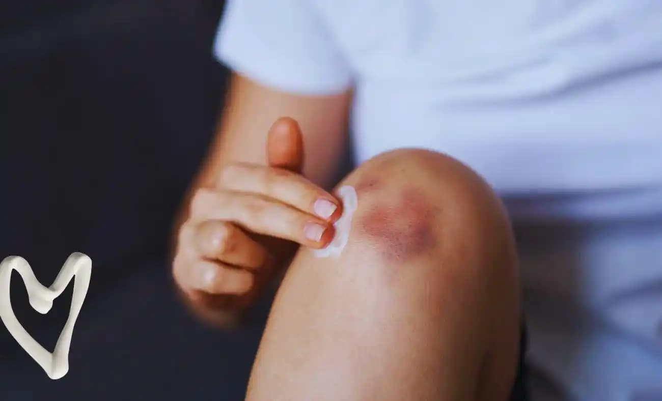 Diz Kararmasının Nedenleri ve Etkili Koruma Yöntemleri Hakkında Detaylı Bilgi