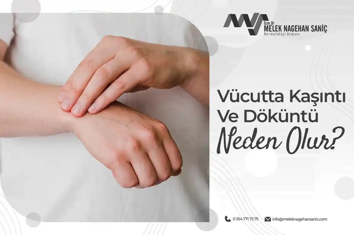 Döküntü Nedir ve Cilt Sağlığını Korumak İçin Bilmeniz Gerekenler