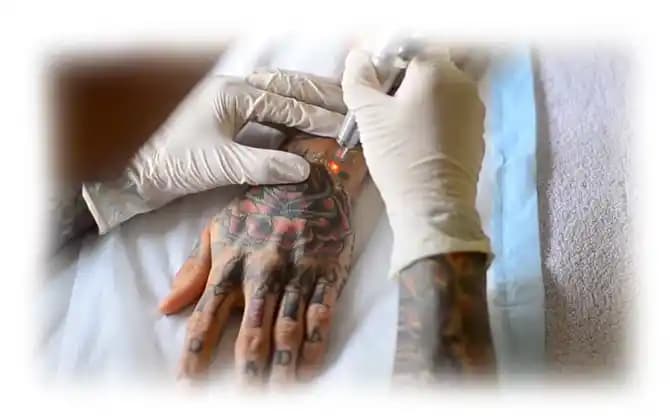 Dövme Yarasında Estetik ve Sağlık Boyutları: Bakım, Tedavi ve İyileşme Süreçleri