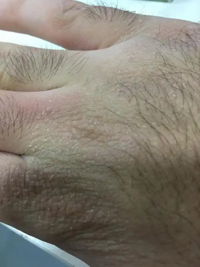 El Kuruluğu ve Nemli Eller İçin Etkili Bakım Yöntemleri ve Doğal Çözümler