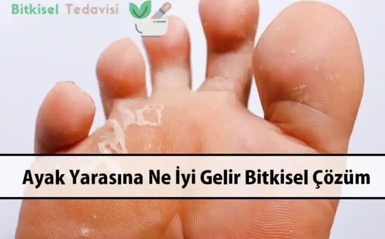 El Yaralarına Yönelik Etkili Tedavi Yöntemleri ve Doğal Çözümler
