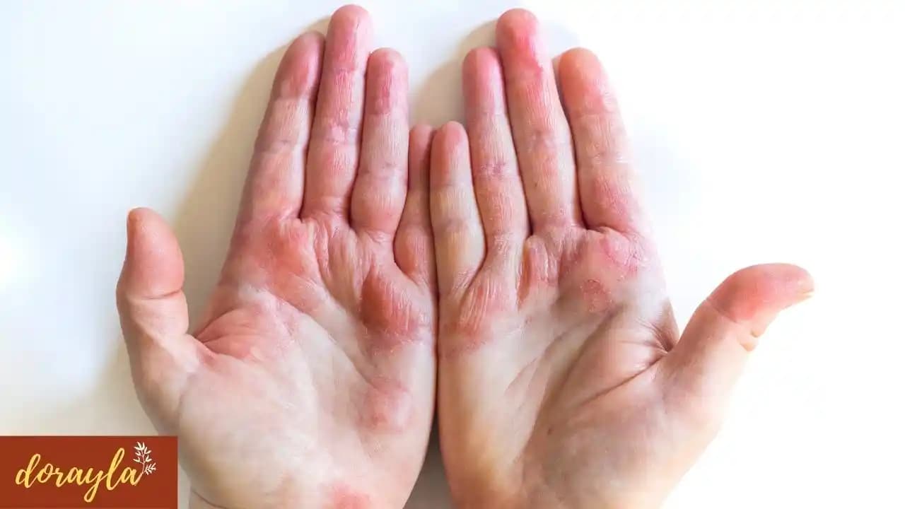 Elde Yara Bakımı ve İyileştirme Yöntemleri Hakkında Kapsamlı Rehber