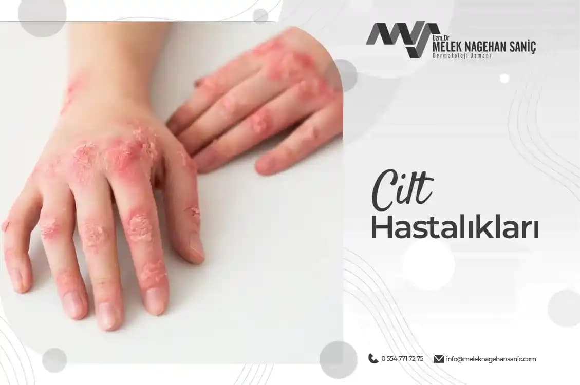 Elde Yara Çıkması ve İyileşme Sürecinde Kozmetik ve Cilt Sağlığı Yaklaşımları