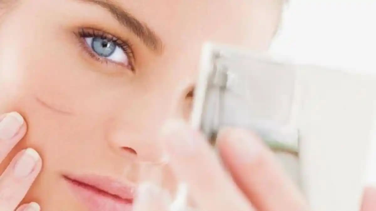 Eski Yara İzleri Nasıl Azaltılır Kozmetik ve Doğal Çözümlerle Güncel Yaklaşımlar