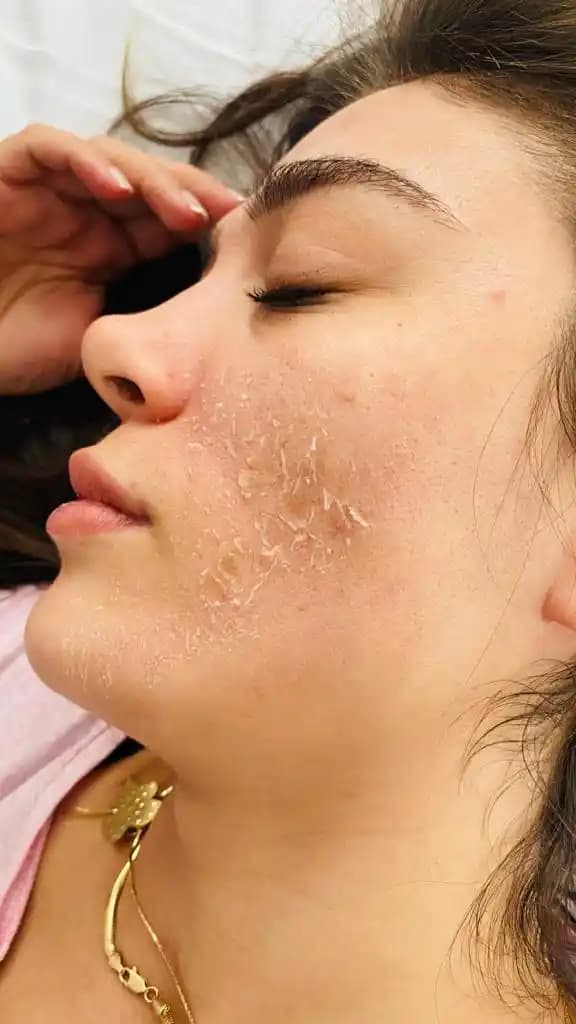 Evde Yosun Peeling Uygulaması ve Cilt Sağlığına Faydaları Hakkında Bilgilendirici Rehber