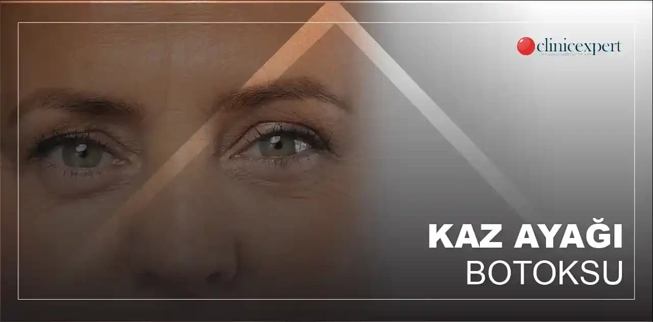 Genç Yaşta Göz Çevresi Kırışıklıklarının Nedenleri ve Etkili Önleme Yöntemleri