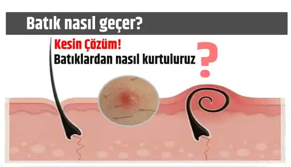 Genital Bölgedeki Batık İzleri Nasıl Geçer: Etkili Yöntemler ve Bakım İpuçları