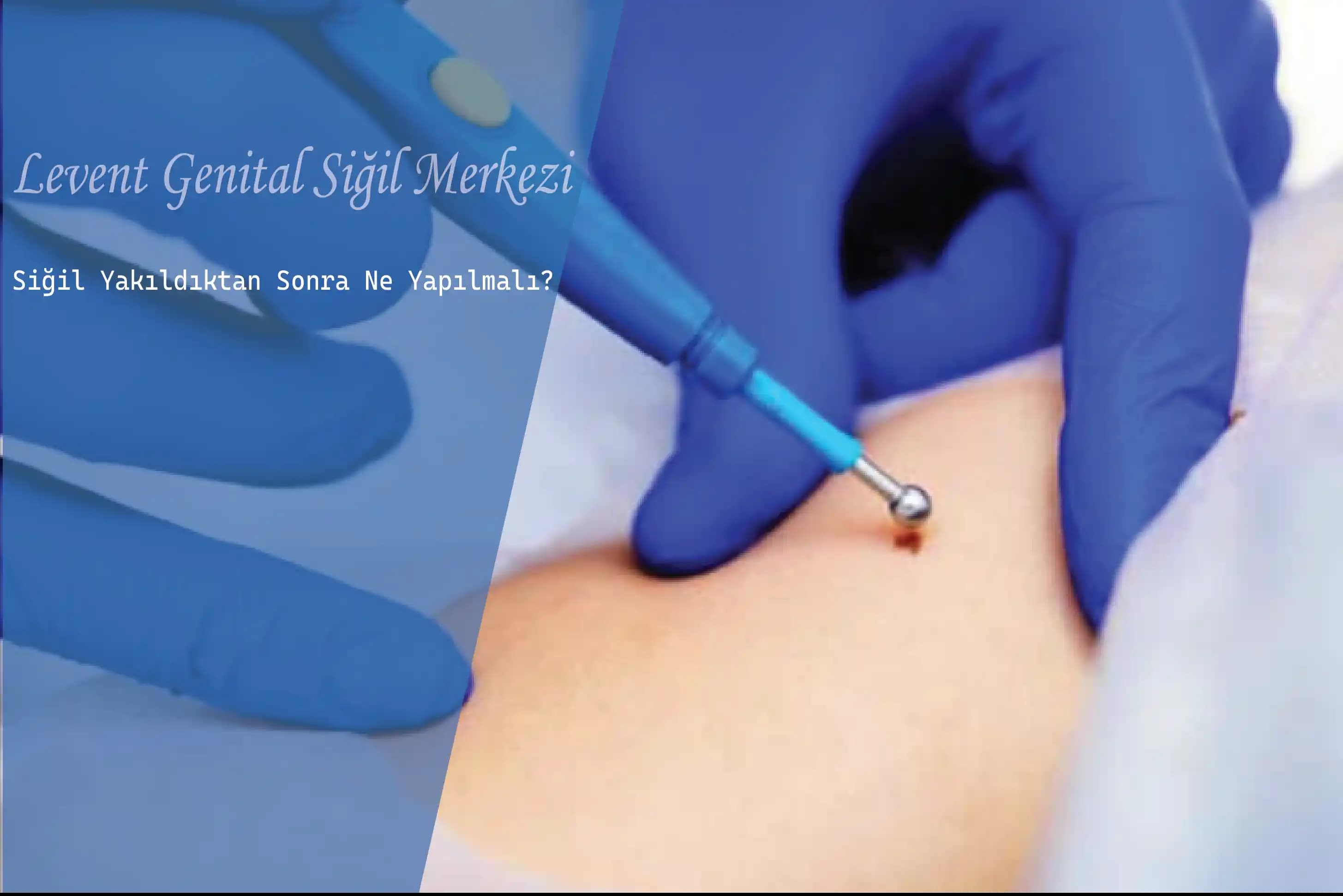 Genital Bölgedeki Kararmayı Azaltmak İçin Etkili Yöntemler ve Profesyonel Çözümler