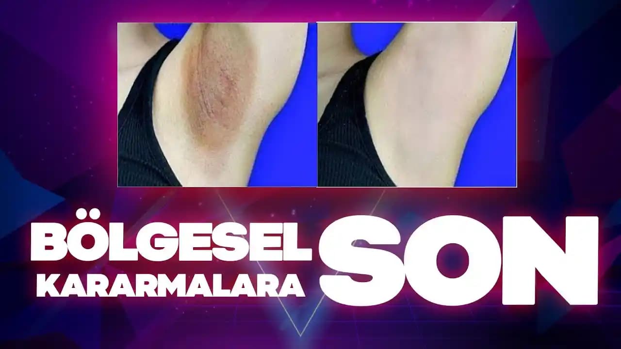 Genital Kararma Nedenleri ve Kozmetik Yaklaşımlar: Etkili Çözüm Yolları ve Güvenli Kullanım