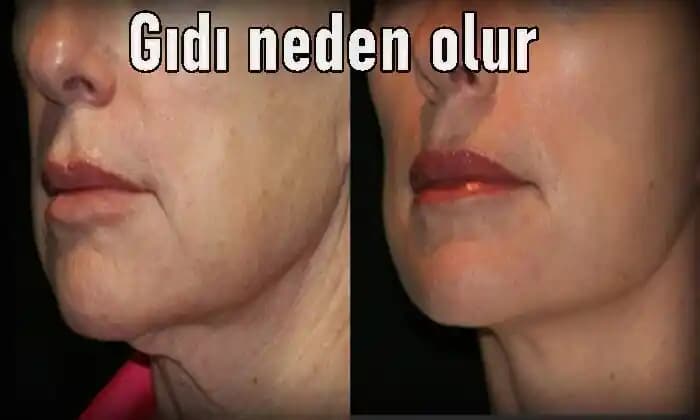 Gıdı Nedenleri ve Çözüm Yöntemleri Hakkında Kapsamlı Bilgi