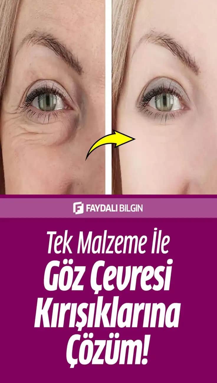 Göz Altı Kırışıklıklarına Karşı Kozmetik ve Doğal Çözümler Rehberi